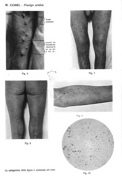 Giornale italiano di dermatologia e sifilologia