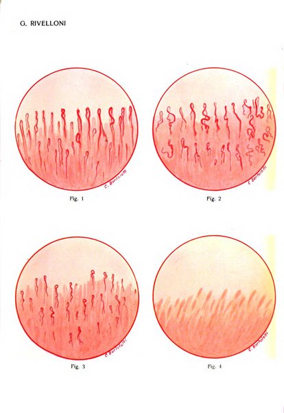 Giornale italiano di dermatologia e sifilologia