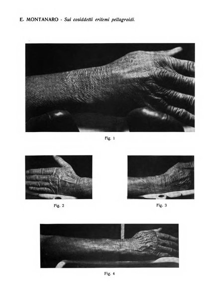 Giornale italiano di dermatologia e sifilologia