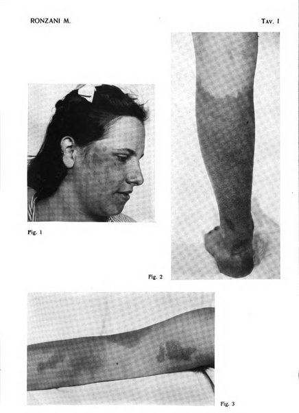 Giornale italiano di dermatologia e sifilologia