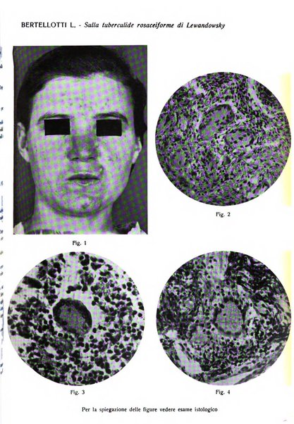 Giornale italiano di dermatologia e sifilologia