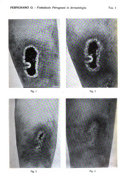 Giornale italiano di dermatologia e sifilologia