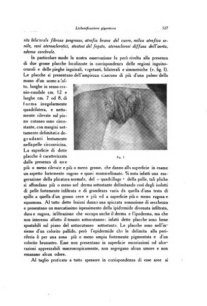 Archivio italiano di dermatologia, sifilografia e venereologia