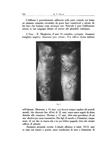 Archivio italiano di dermatologia, sifilografia e venereologia