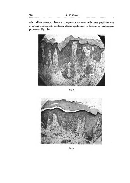 Archivio italiano di dermatologia, sifilografia e venereologia