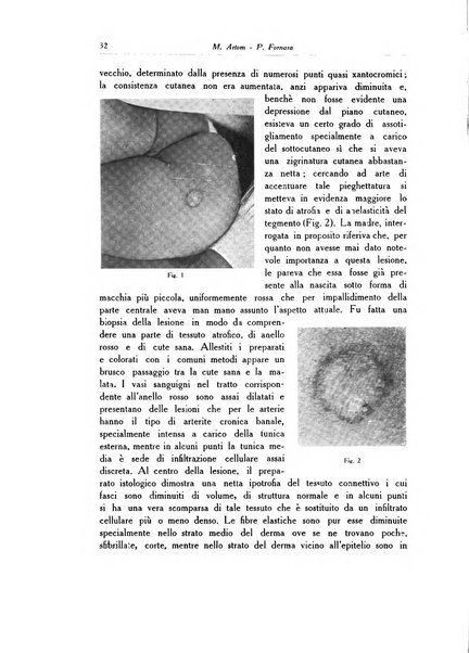 Archivio italiano di dermatologia, sifilografia e venereologia