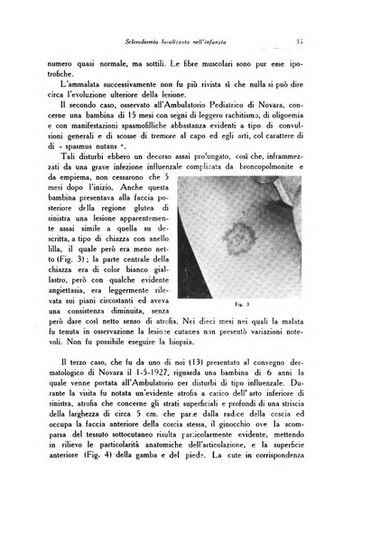 Archivio italiano di dermatologia, sifilografia e venereologia