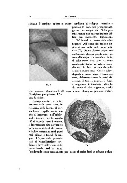 Archivio italiano di dermatologia, sifilografia e venereologia