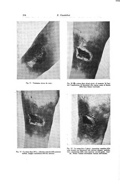 Archivio italiano di dermatologia, sifilografia e venereologia