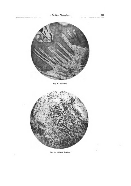 Archivio italiano di dermatologia, sifilografia e venereologia