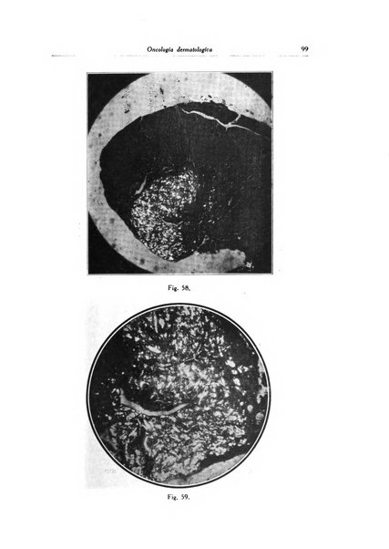 Archivio italiano di dermatologia, sifilografia e venereologia