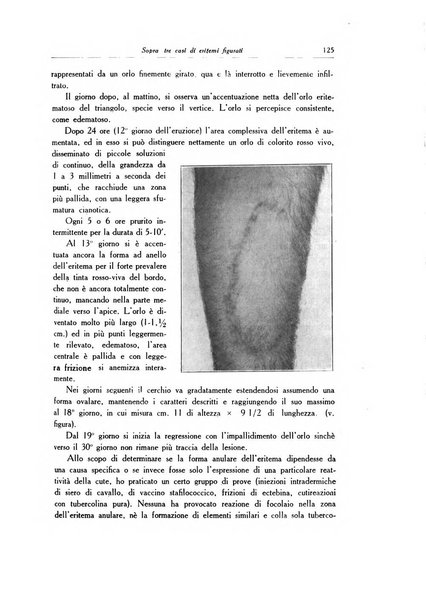 Archivio italiano di dermatologia, sifilografia e venereologia