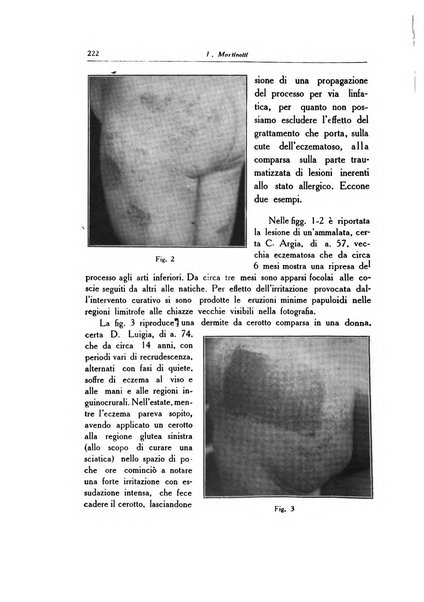 Archivio italiano di dermatologia, sifilografia e venereologia