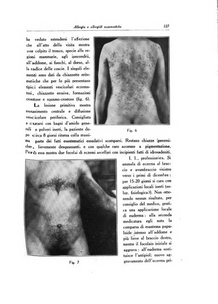 Archivio italiano di dermatologia, sifilografia e venereologia