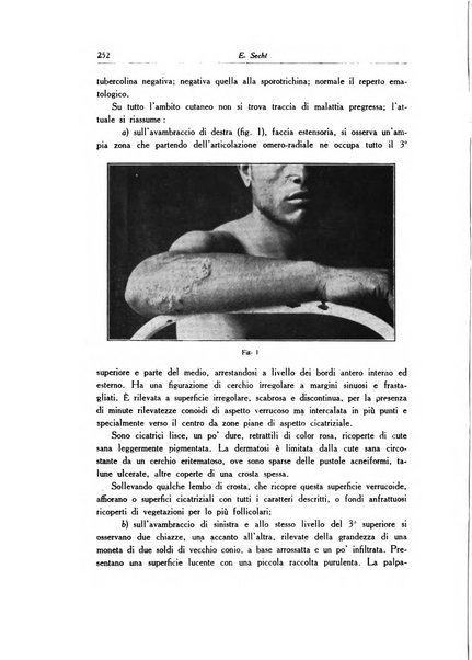 Archivio italiano di dermatologia, sifilografia e venereologia