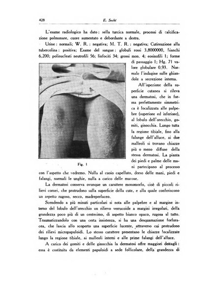 Archivio italiano di dermatologia, sifilografia e venereologia