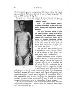 giornale/SBL0505701/1935/unico/00000098