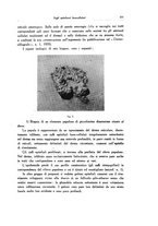 giornale/SBL0505701/1935/unico/00000355