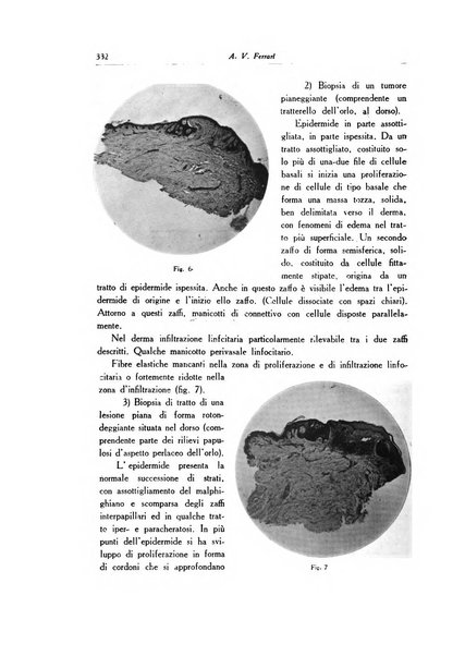 Archivio italiano di dermatologia, sifilografia e venereologia