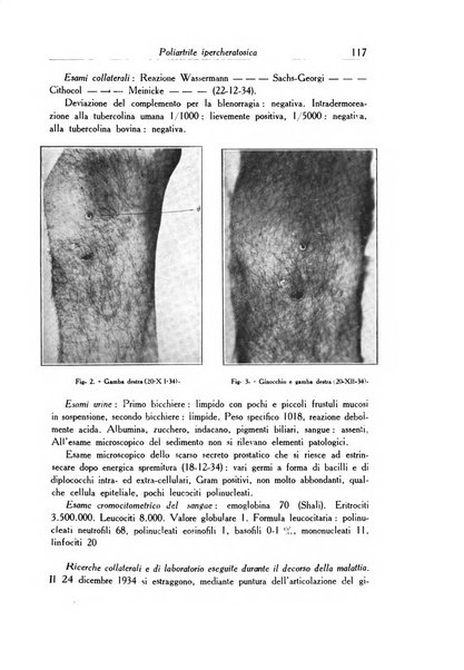 Archivio italiano di dermatologia, sifilografia e venereologia