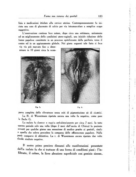 Archivio italiano di dermatologia, sifilografia e venereologia