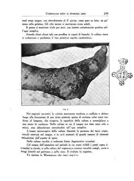 Archivio italiano di dermatologia, sifilografia e venereologia