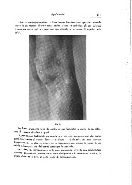 Archivio italiano di dermatologia, sifilografia e venereologia