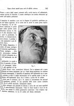 giornale/SBL0505701/1937/unico/00000155