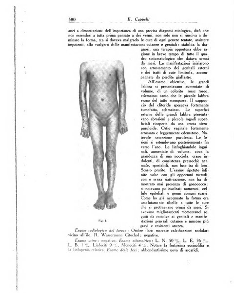 Archivio italiano di dermatologia, sifilografia e venereologia