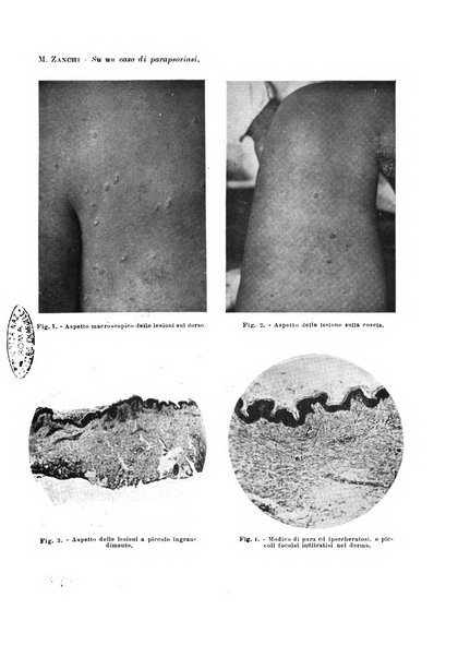 Archivio italiano di dermatologia, sifilografia e venereologia