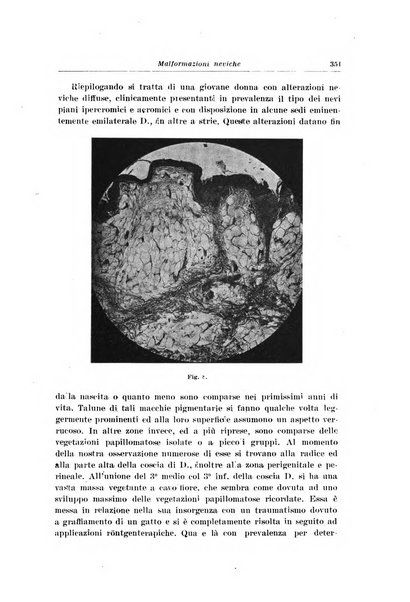 Archivio italiano di dermatologia, sifilografia e venereologia