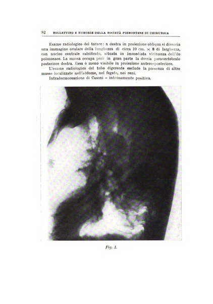 Bollettino e memorie della Società piemontese di chirurgia