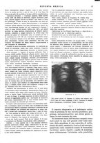 giornale/TO00014601/1929/9.2/00000083