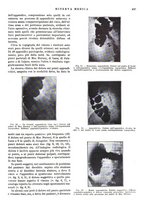 giornale/TO00014601/1929/9.2/00000607