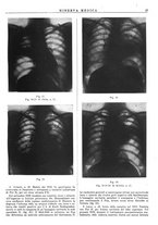 giornale/TO00014601/1941/v.32.2/00000049