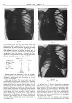 giornale/TO00014601/1941/v.32.2/00000052