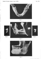 giornale/TO00014635/1917/unico/00000201