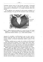 giornale/TO00014635/1935/unico/00000225