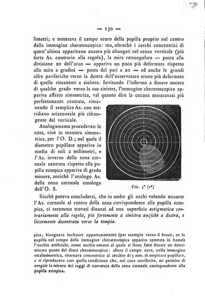 Annali di ottalmologia