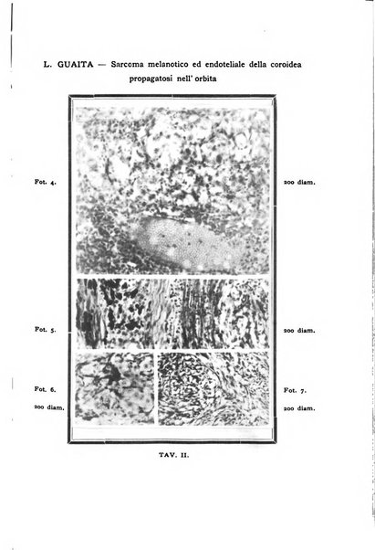 Annali di ottalmologia