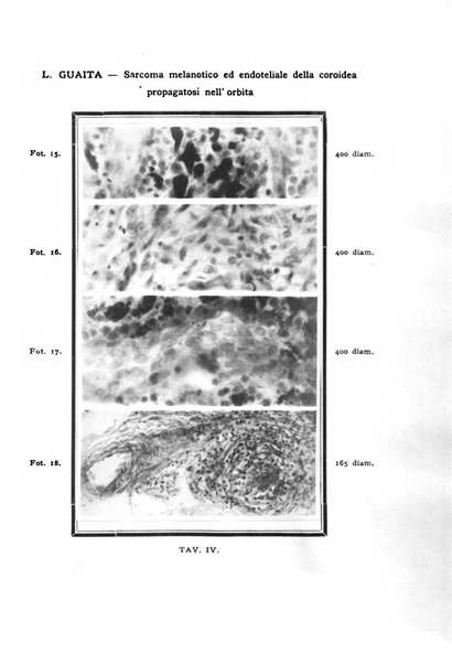 Annali di ottalmologia