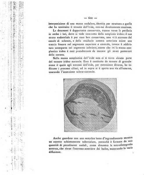 Annali di ottalmologia