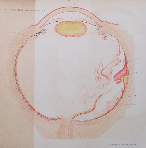 Annali di ottalmologia