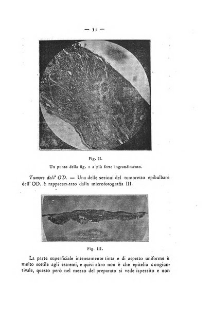 Annali di ottalmologia