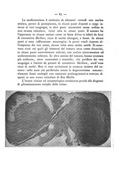 Annali di ottalmologia