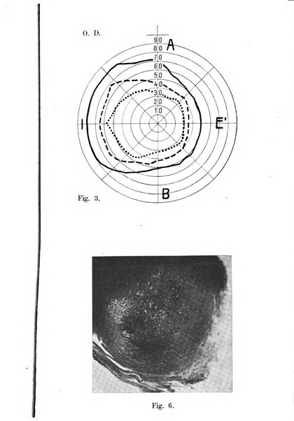 Annali di ottalmologia