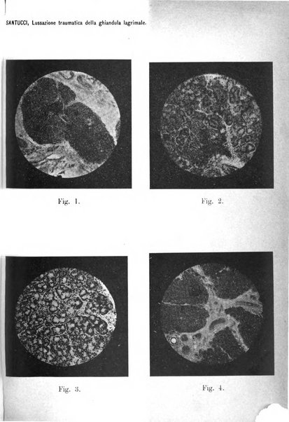 Annali di ottalmologia