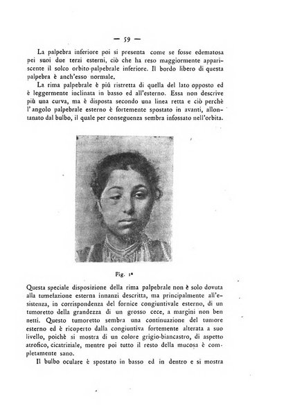 Annali di ottalmologia