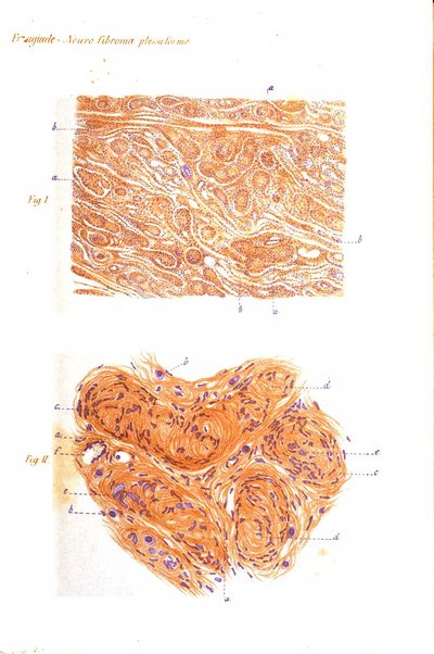 Annali di ottalmologia