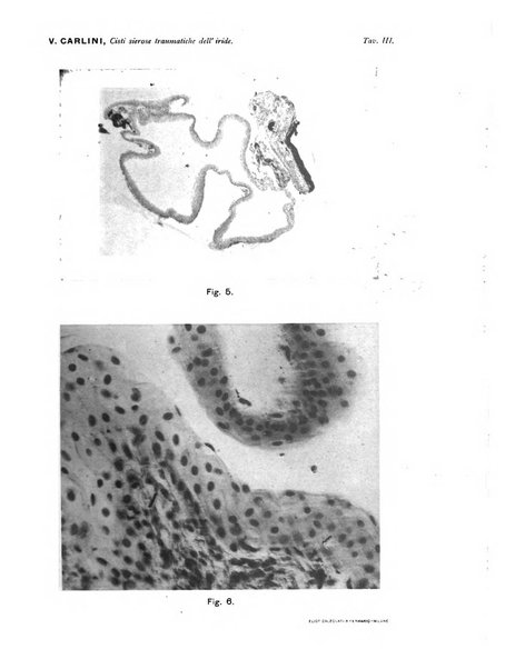 Annali di ottalmologia